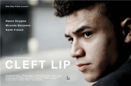Cleft Lip (2018) Online